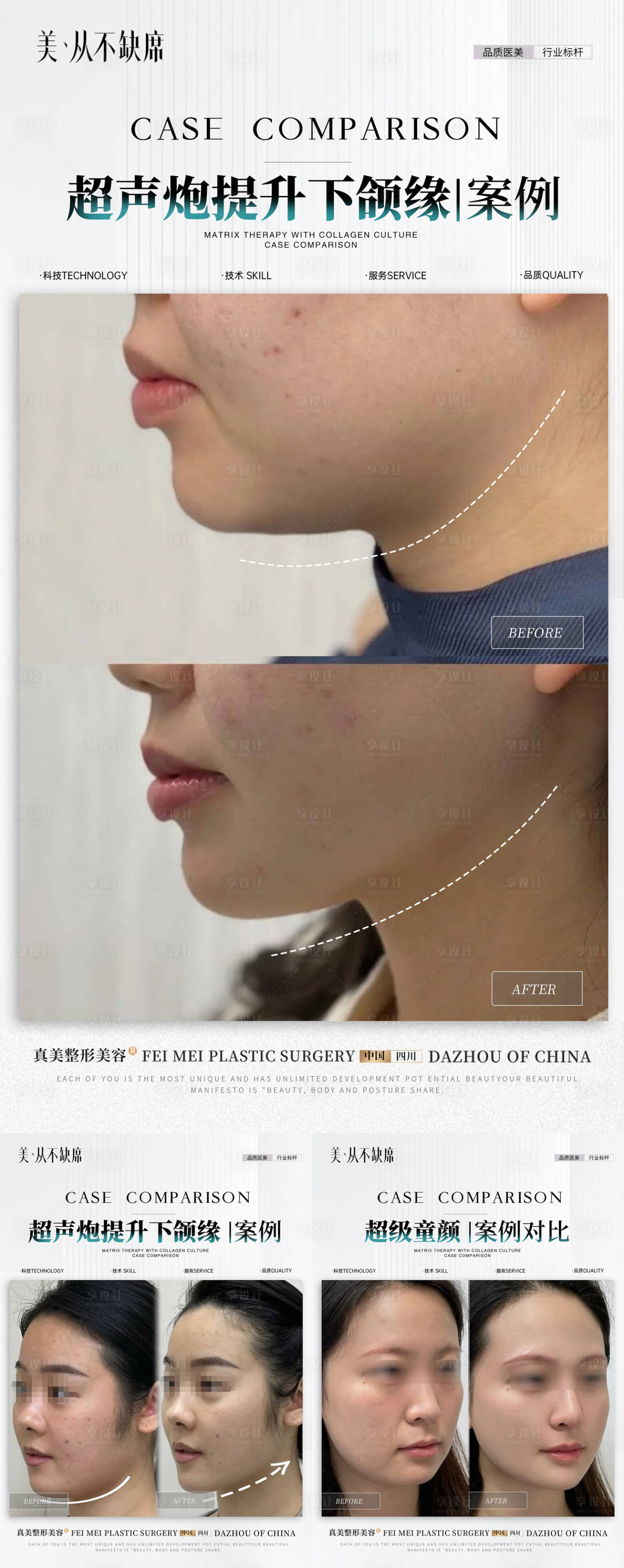源文件下載【享設計】搜索編號：23270027887865355【醫美抗衰案例對比】