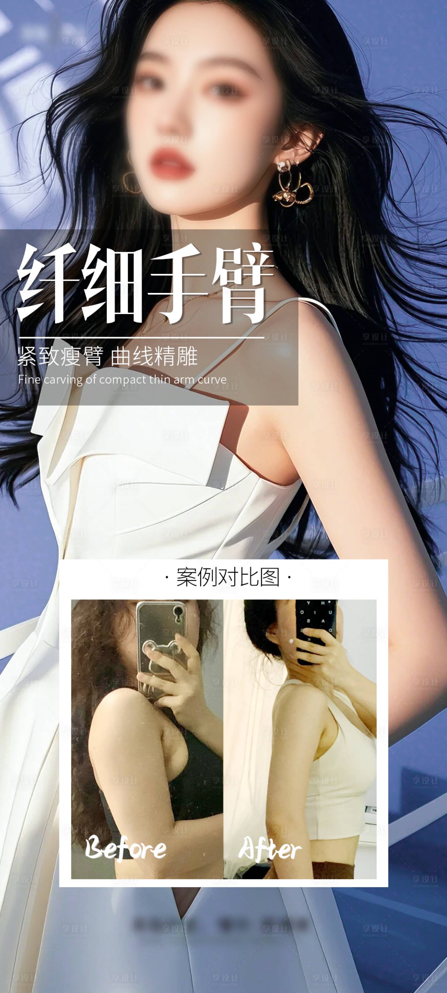 源文件下载【享设计】搜索编号：17710028144949229【医美手臂环吸案例海报】