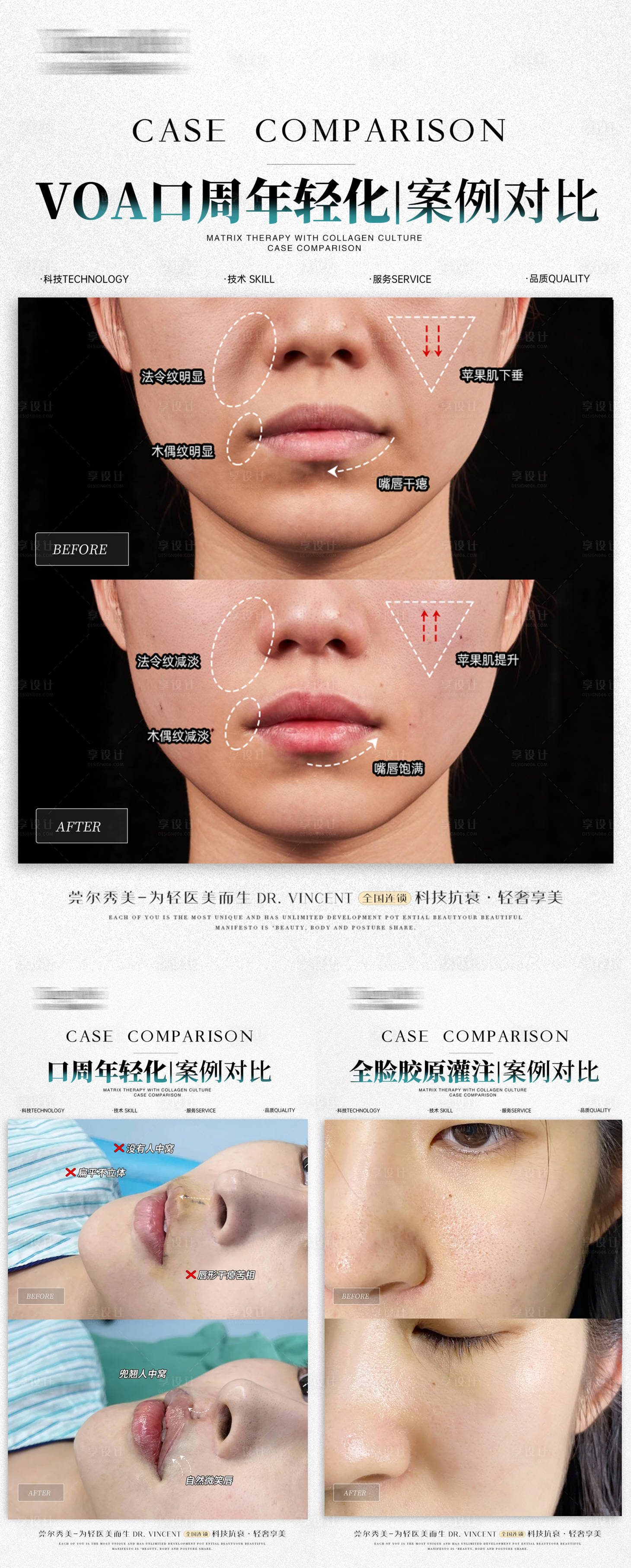 源文件下載【醫美案例對比】編號：94670027854477368