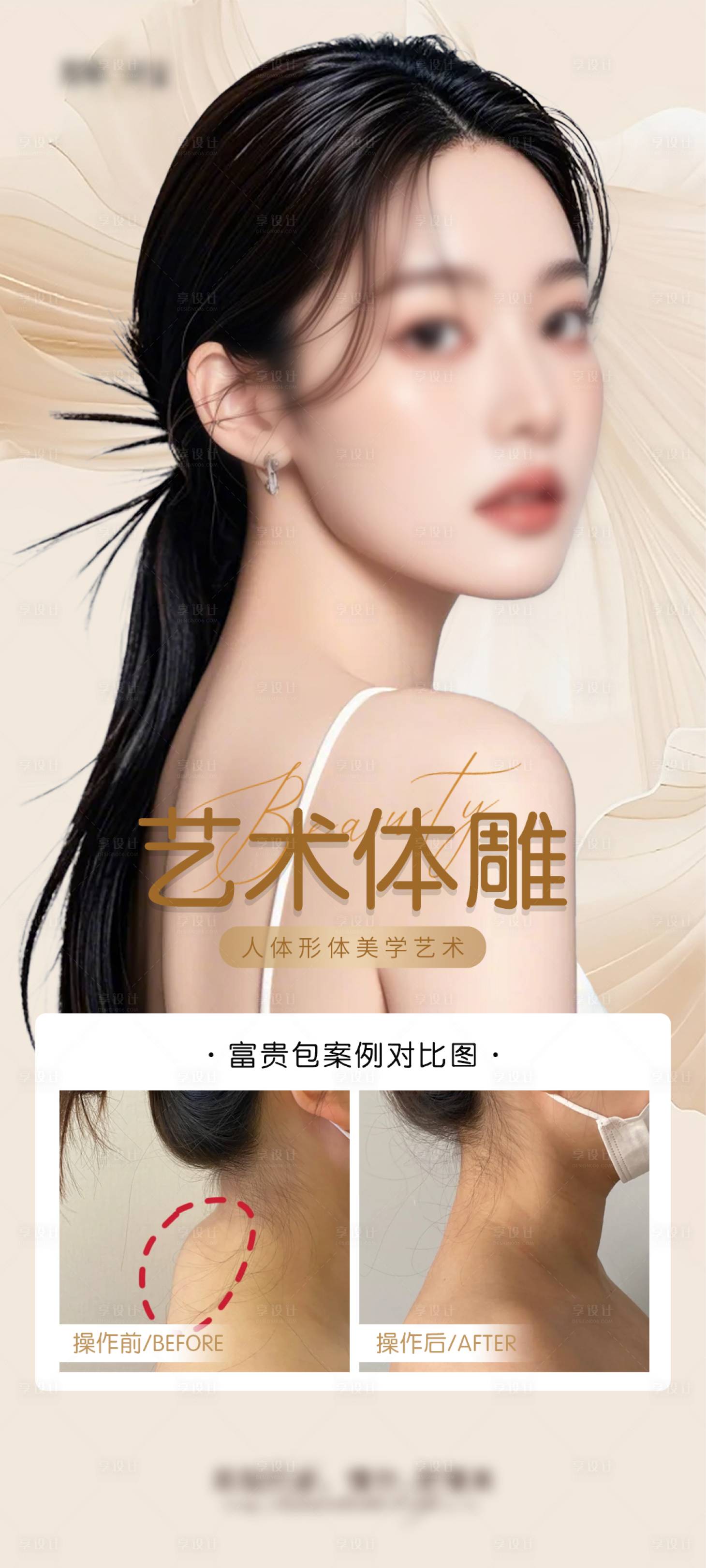 源文件下載【享設計】搜索編號：65220027920167073【祛除富貴包案例海報】