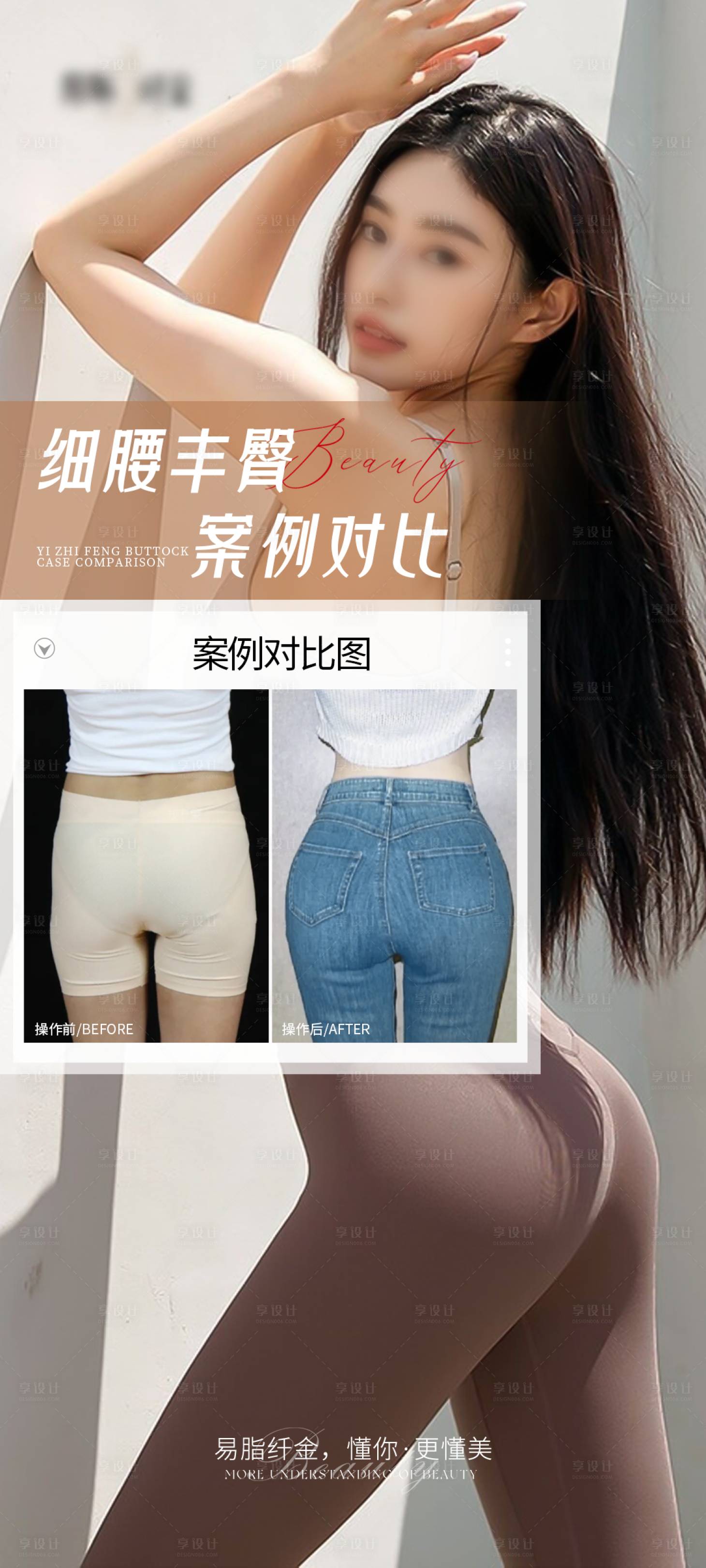 源文件下载【享设计】搜索编号：40110027971739972【医美丰臀案例对比海报】