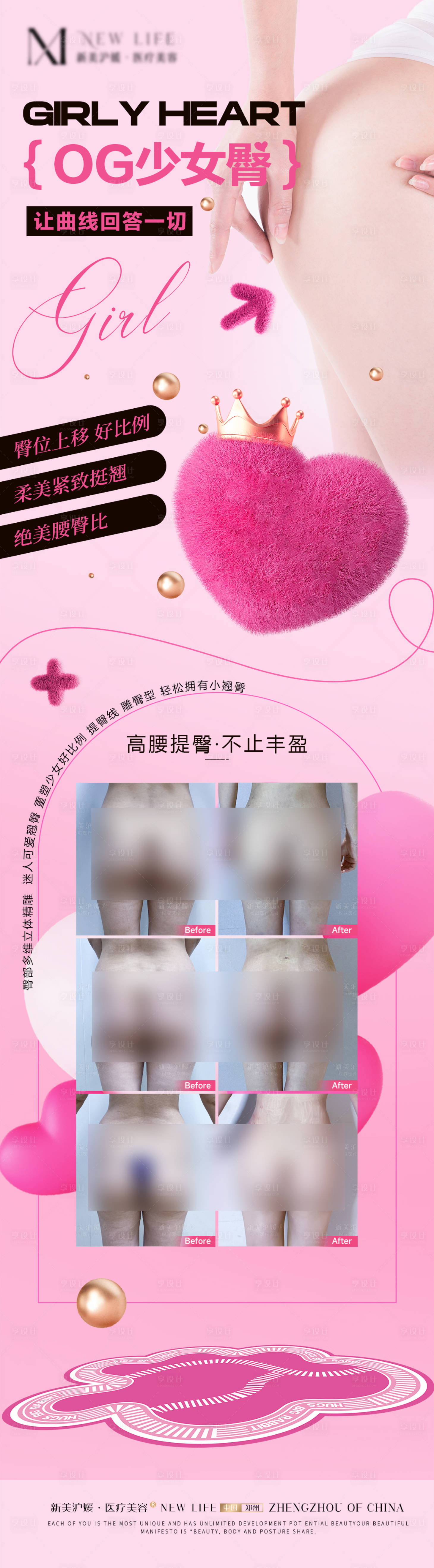 源文件下载【享设计】搜索编号：13090027758732931【医美丰臀新品海报】