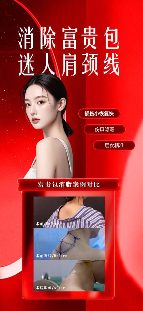 源文件下载【富贵包案例海报】编号：22540028107908813