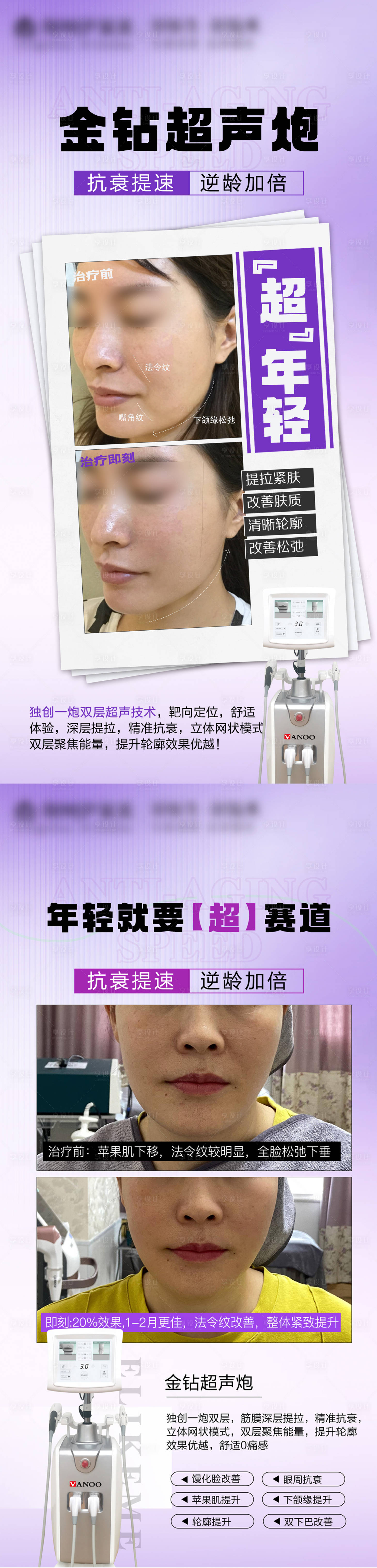 源文件下載【享設計】搜索編號：38450027887923357【醫美案例超聲炮】