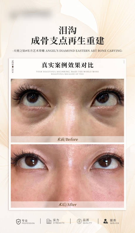 源文件下载【享设计】搜索编号：25060027677313946【泪沟案例对比海报】