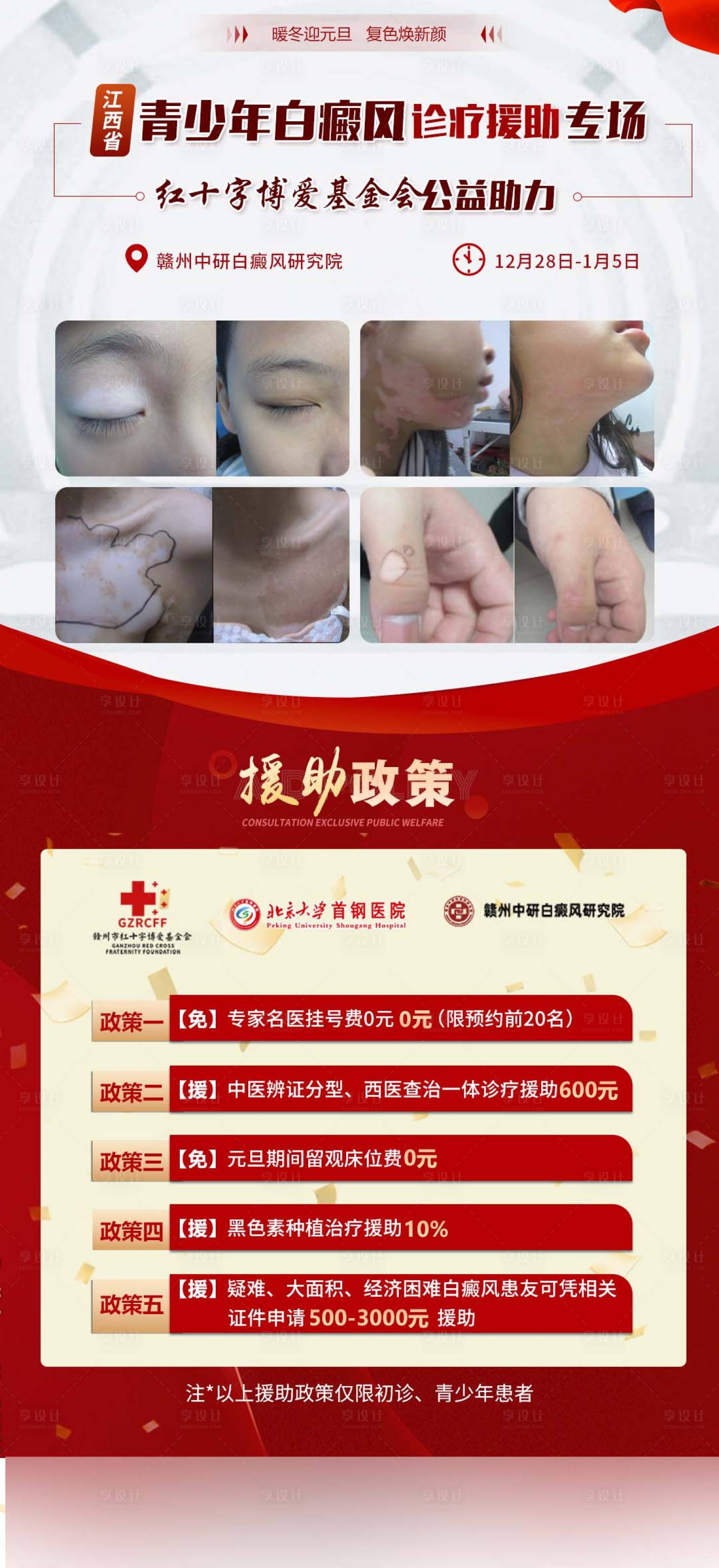 源文件下载【专家会诊白癜风科普援助公益海报】编号：31360028121543509