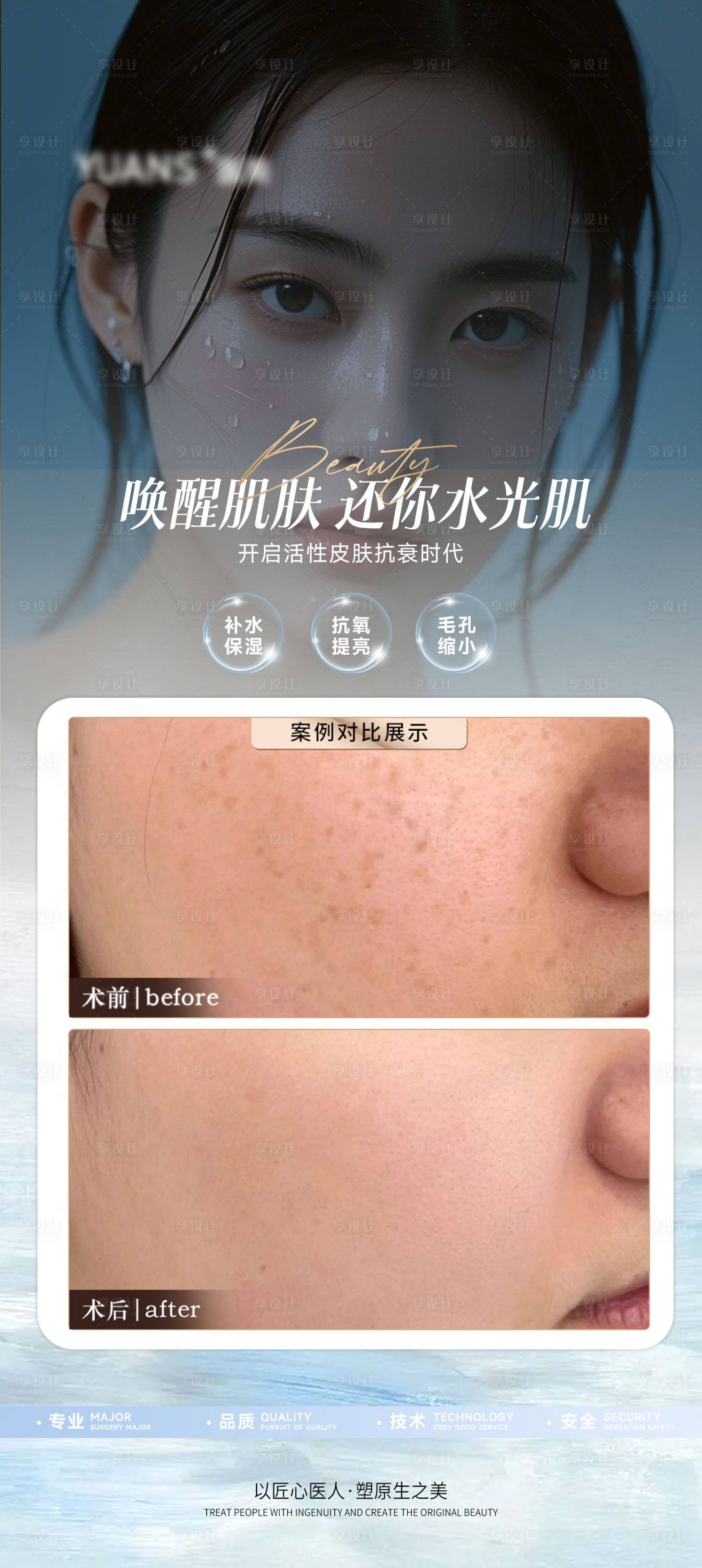 源文件下载【享设计】搜索编号：16810027880655613【医美水光案例对比】