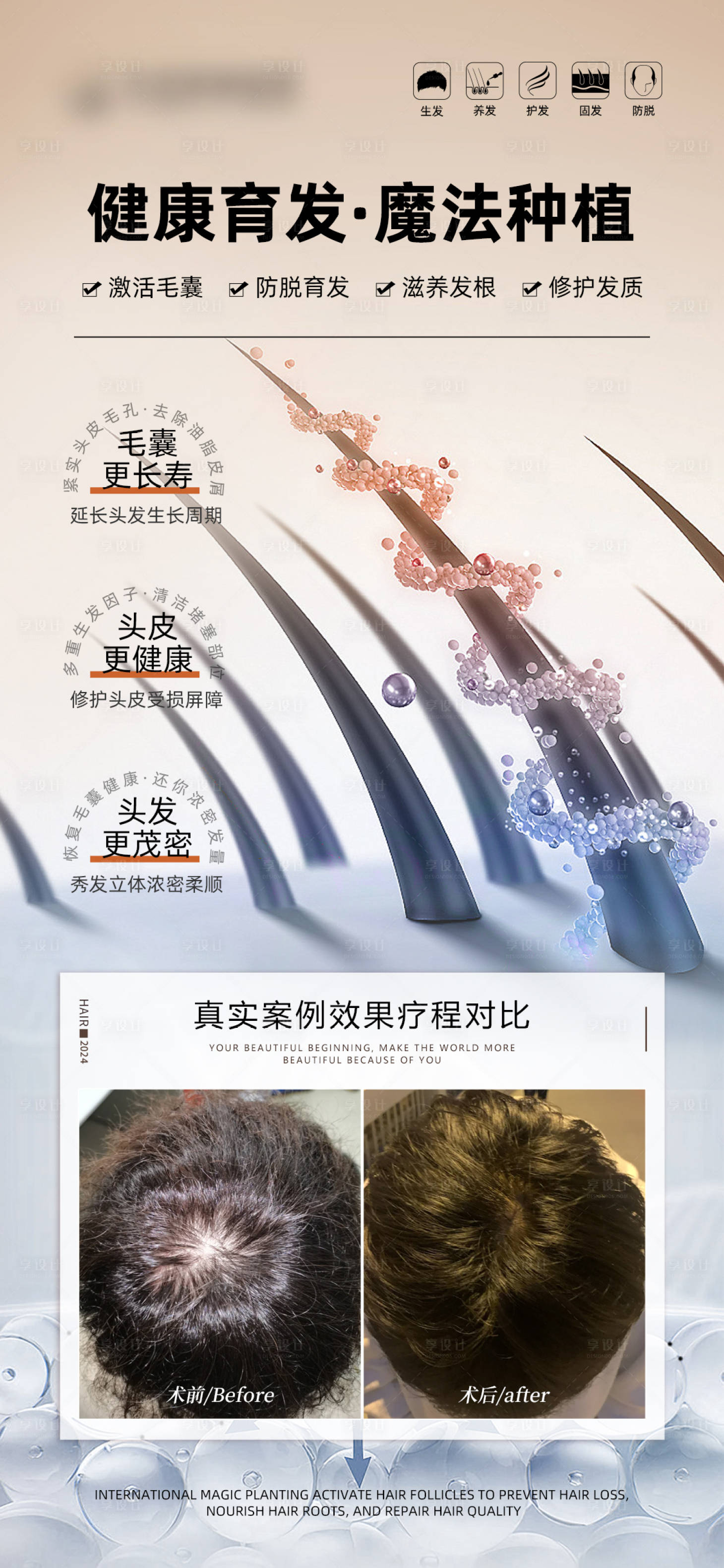 源文件下载【享设计】搜索编号：85730027670833689【健康育发生发案例海报】