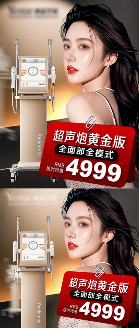 源文件下载【超声炮CPM】编号：50120027784198618