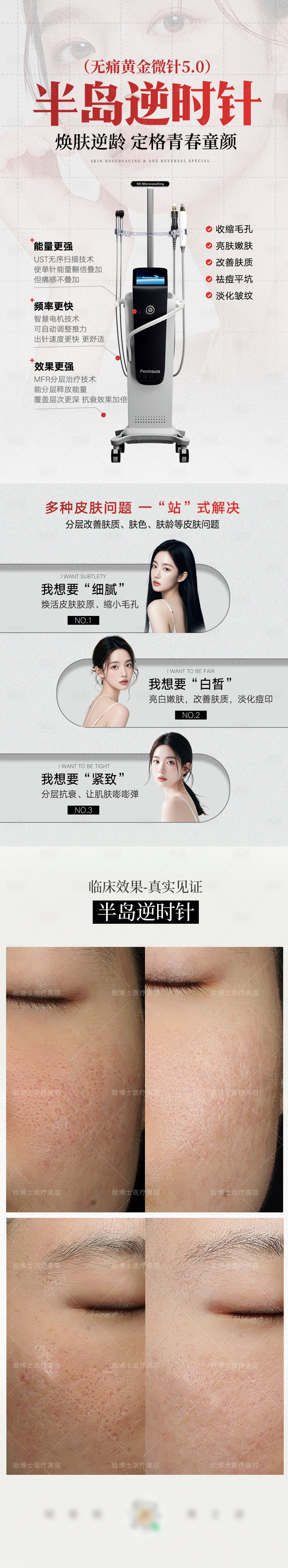 源文件下载【享设计】搜索编号：25290028123532621【医美黄金微针海报 】