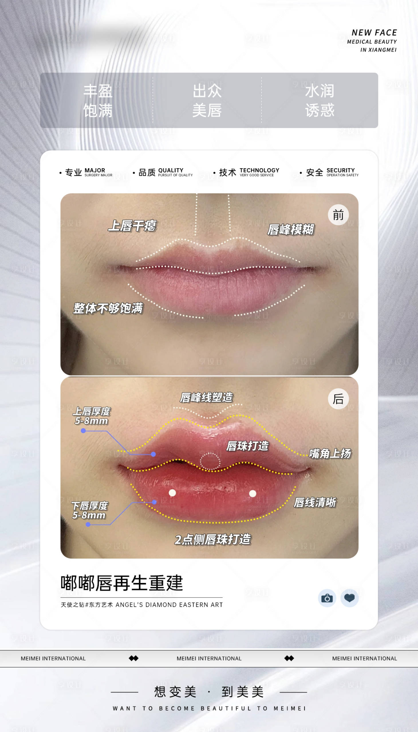 源文件下載【享設計】搜索編號：68950027667931343【嘟嘟唇再生重建】