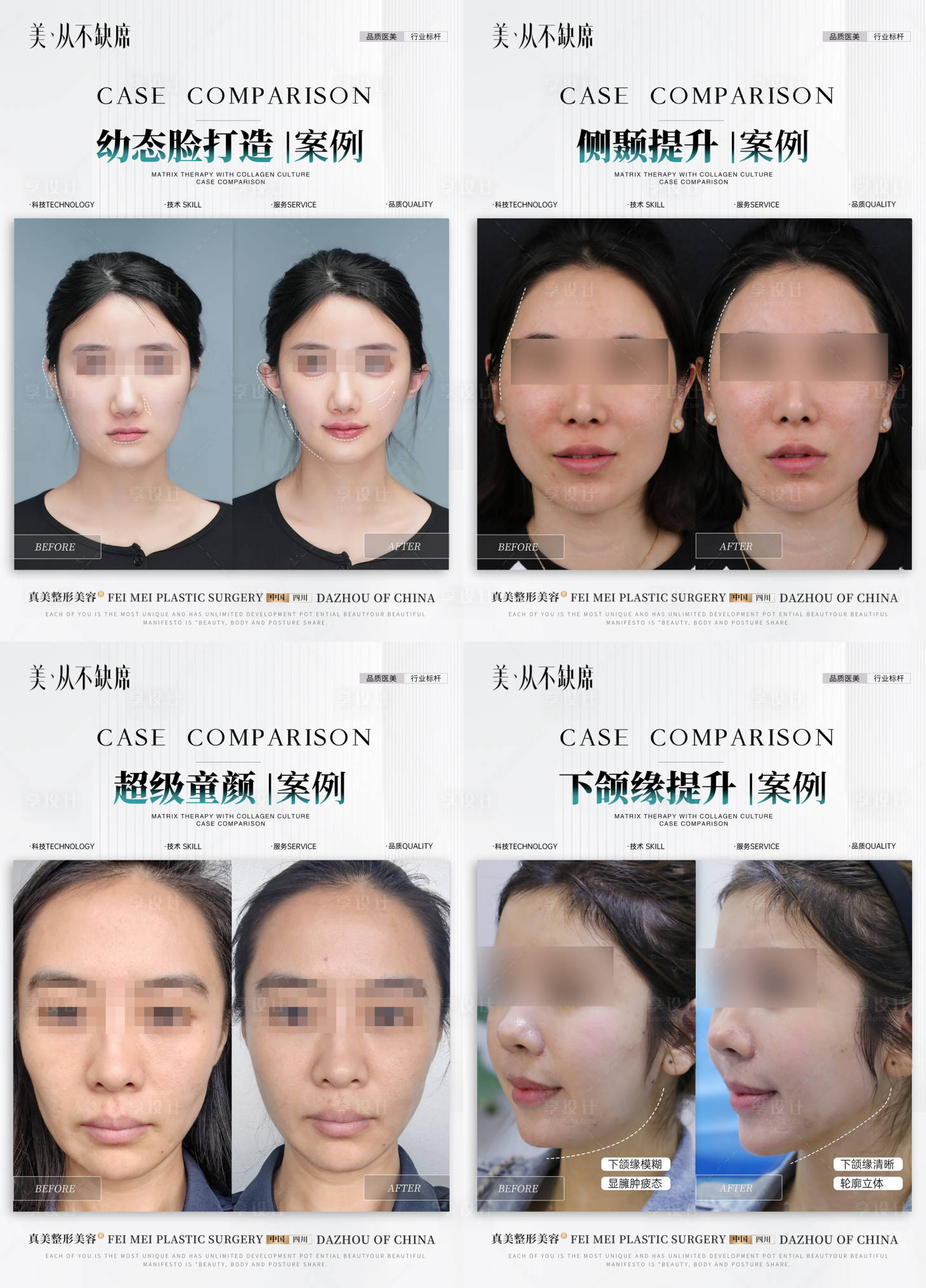 源文件下载【享设计】搜索编号：90060027730149776【医美简约案例对比】