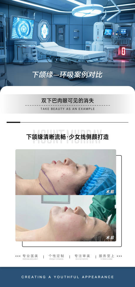 源文件下載【享設計】搜索編號：32450027688585879【醫美下頜緣吸脂案例對比】