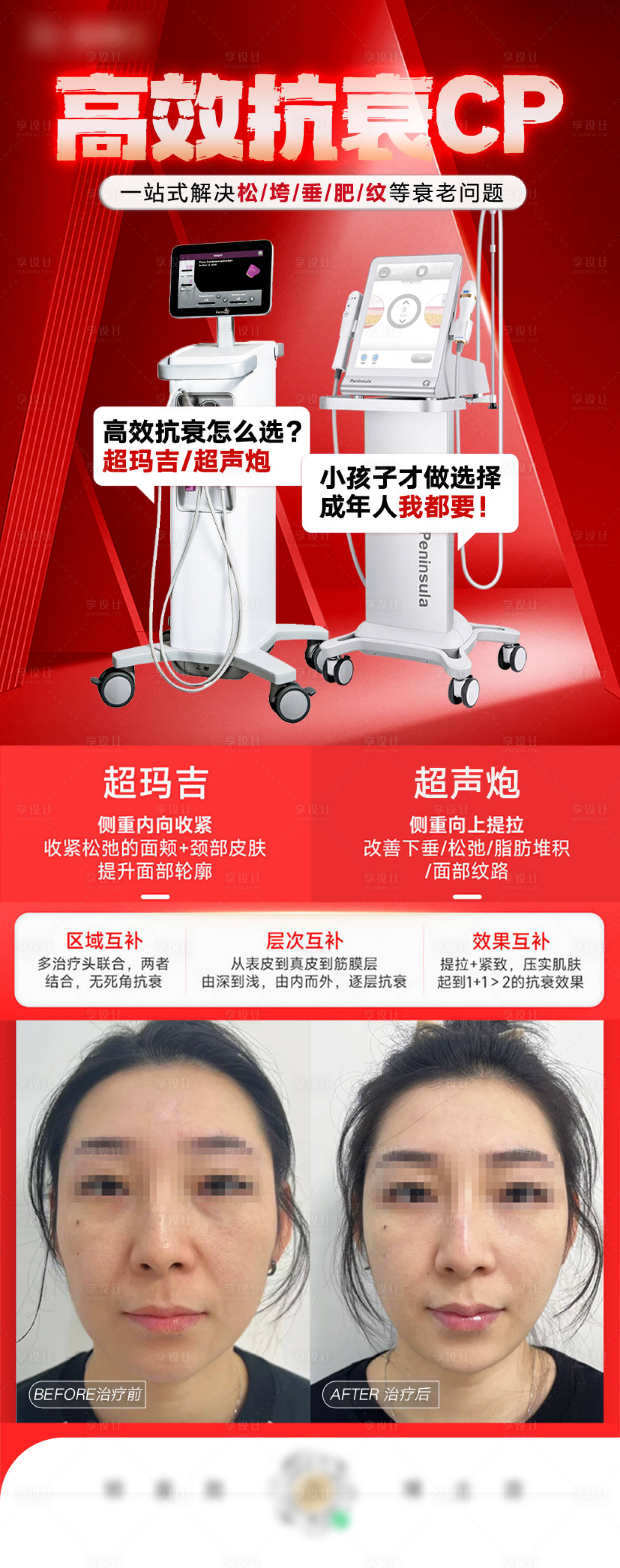 源文件下載【享設計】搜索編號：23960028123431722【醫美超瑪吉 超聲炮案例海報】
