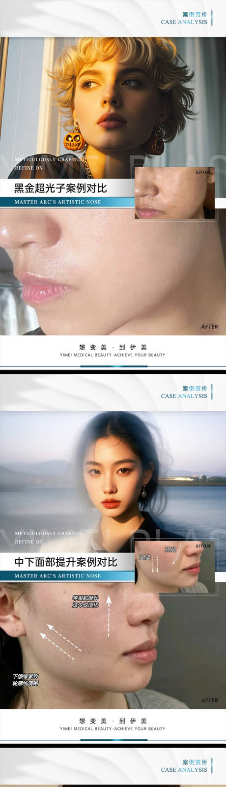 源文件下载【享设计】搜索编号：43900027971275977【医美案例对比模板】