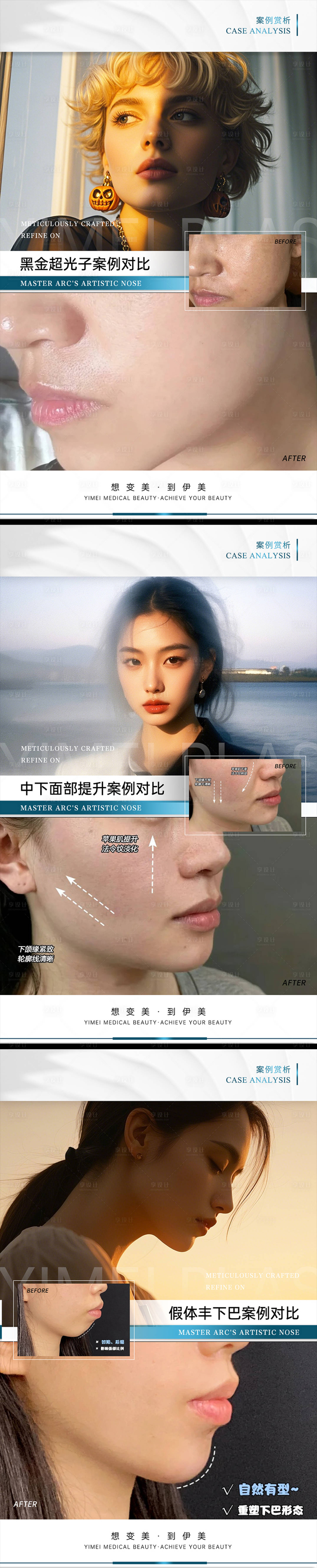 源文件下载【享设计】搜索编号：43900027971275977【医美案例对比模板】