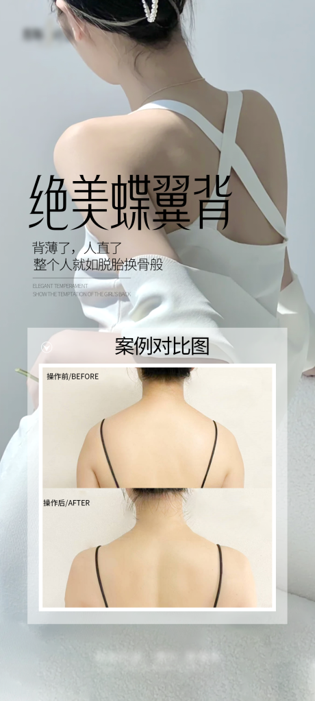 源文件下载【医美少女背案例海报】编号：78120028036203934