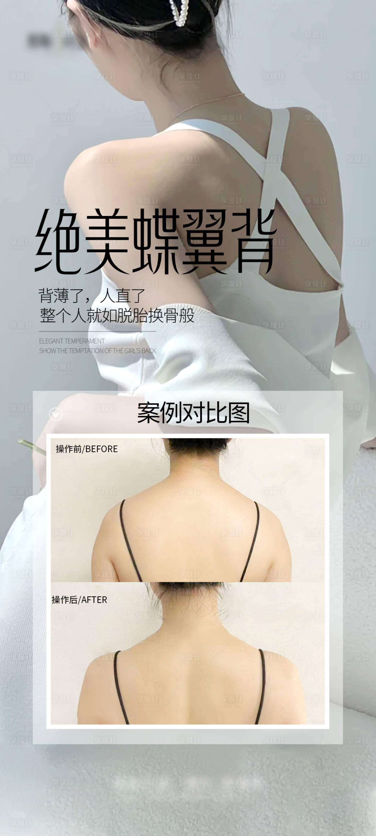 源文件下载【享设计】搜索编号：78120028036203934【医美少女背案例海报】