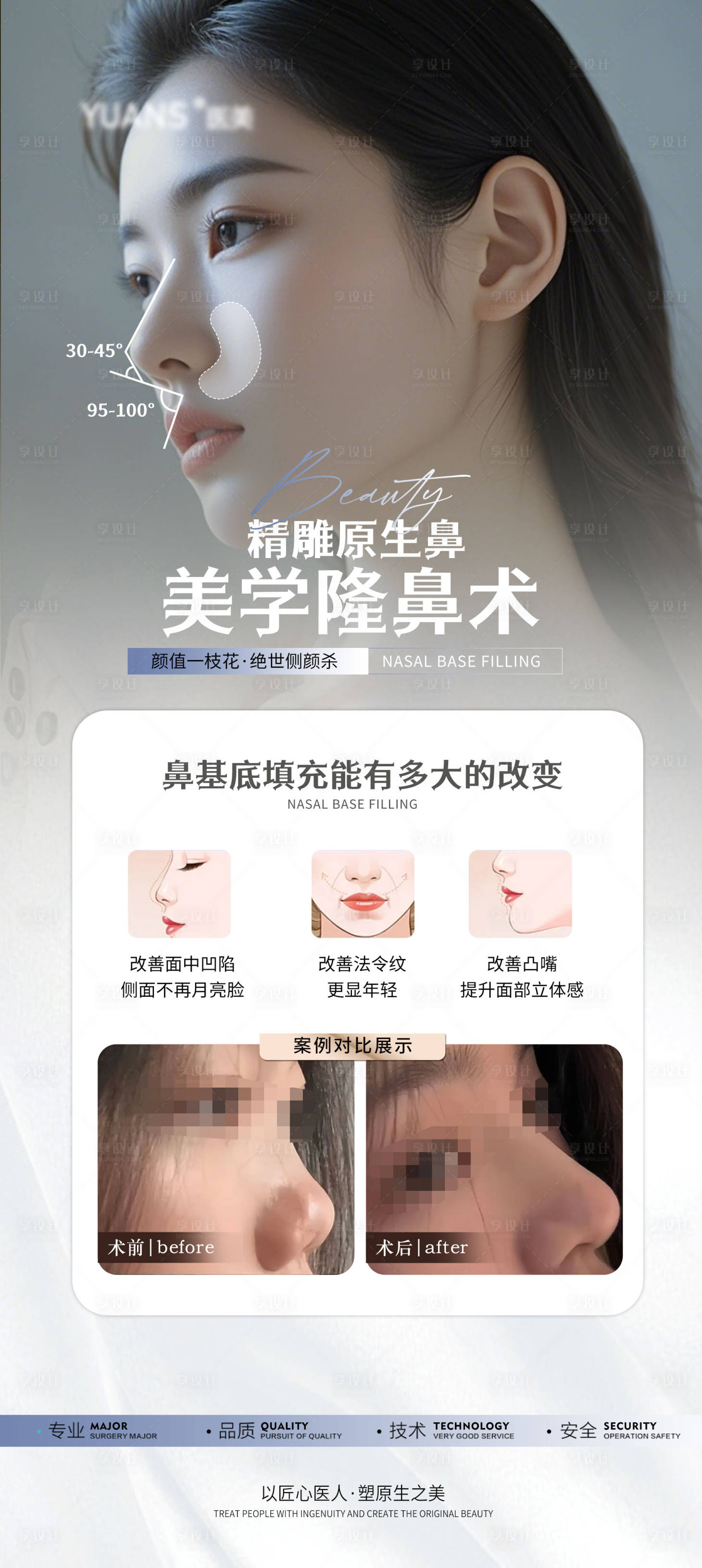 源文件下載【享設(shè)計】搜索編號：99840027626897382【醫(yī)美隆鼻科普案例海報】