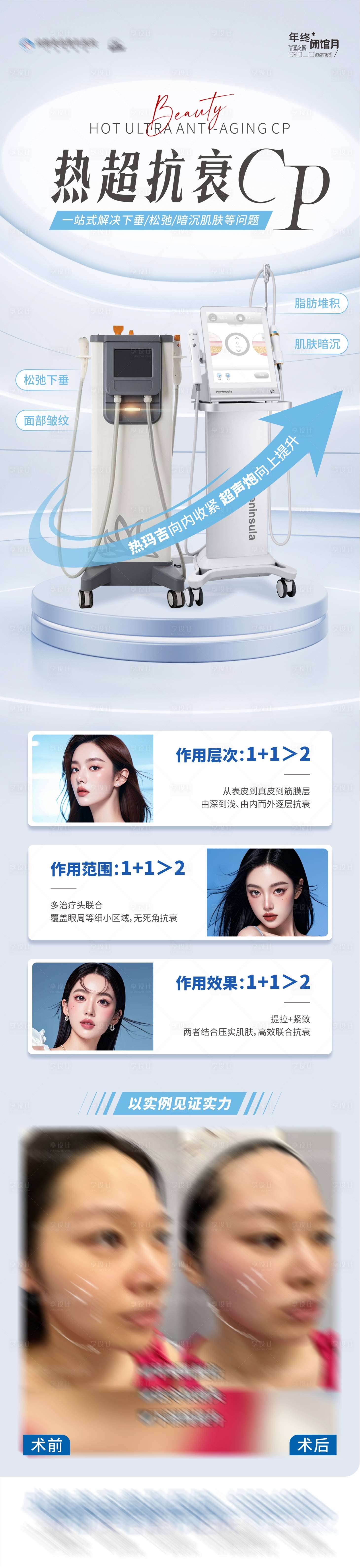 源文件下载【享设计】搜索编号：15100027674413731【医美热玛吉超声炮仪器抗衰案例长图】