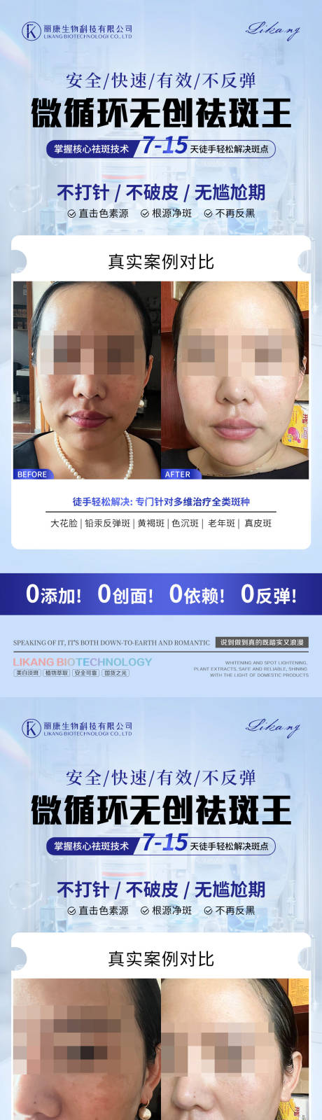 源文件下載【享設計】搜索編號：99100027859368569【醫美祛斑案例對比系列海報】