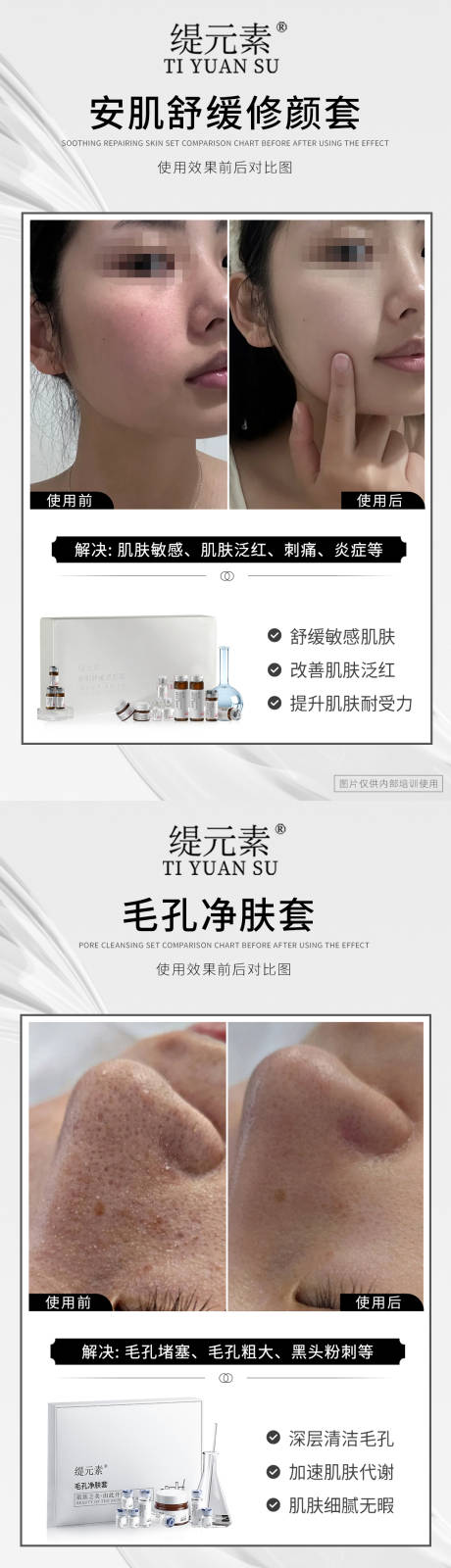 源文件下载【毛孔清洁对比图】编号：60720027909545741