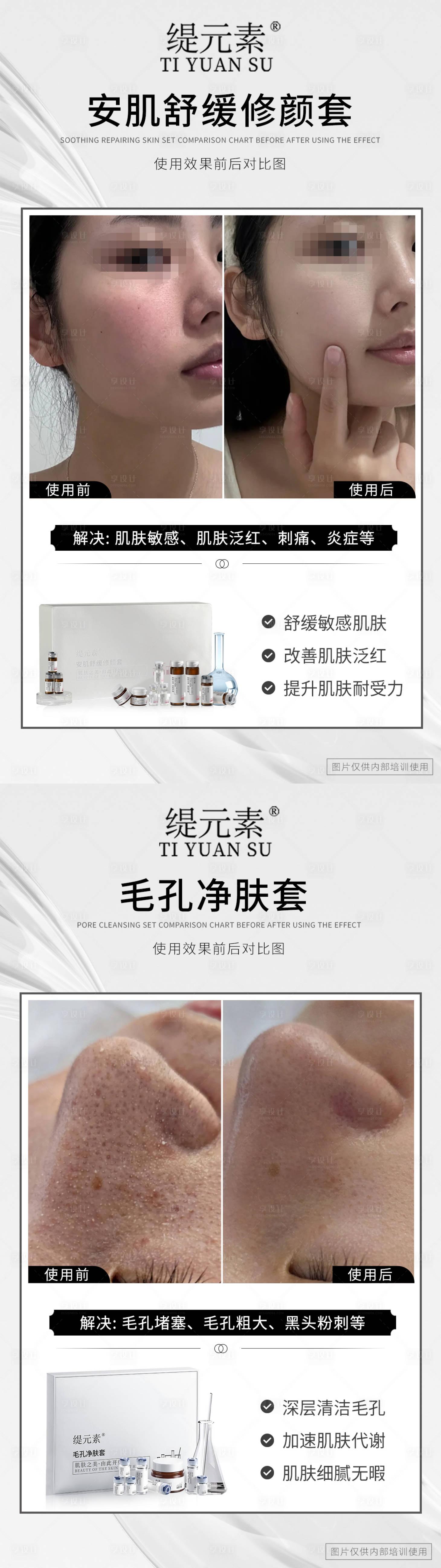 源文件下载【享设计】搜索编号：60720027909545741【毛孔清洁对比图】