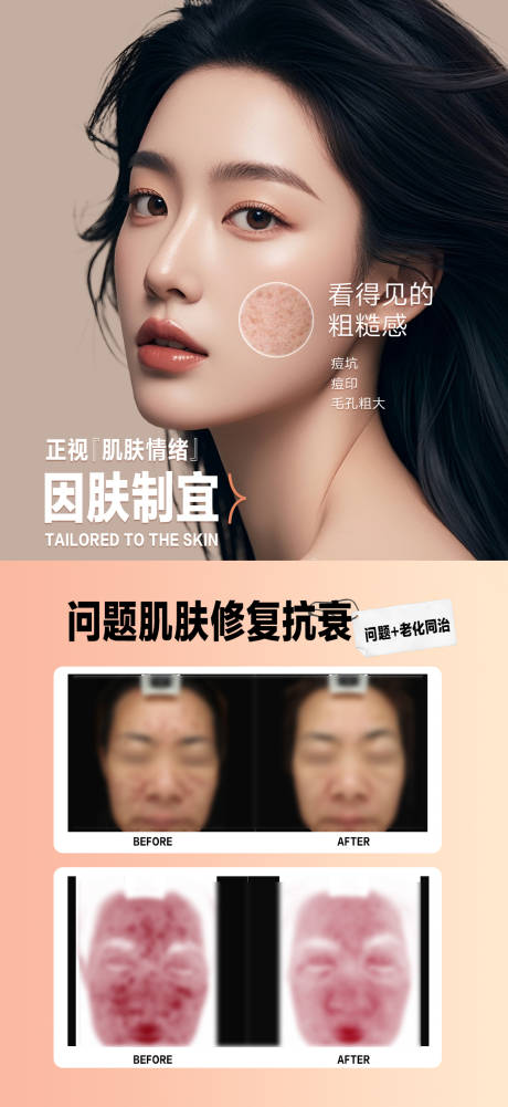 源文件下载【享设计】搜索编号：36000027901094097【祛斑祛痘案例】