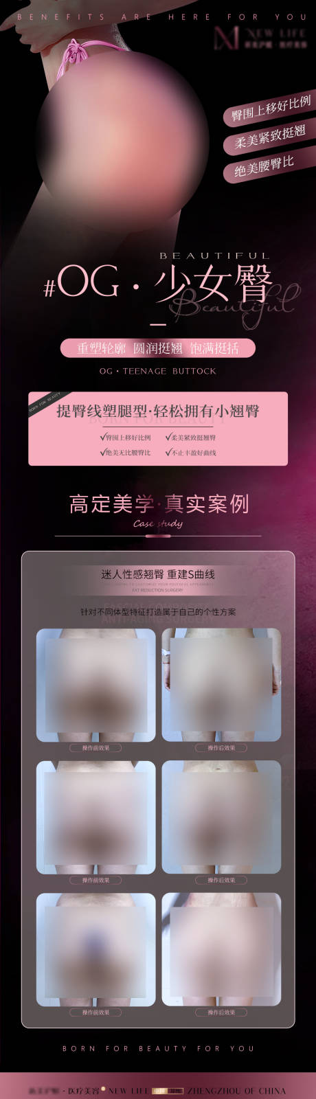 源文件下载【医美丰臀品相案例海报】编号：76610027755378055