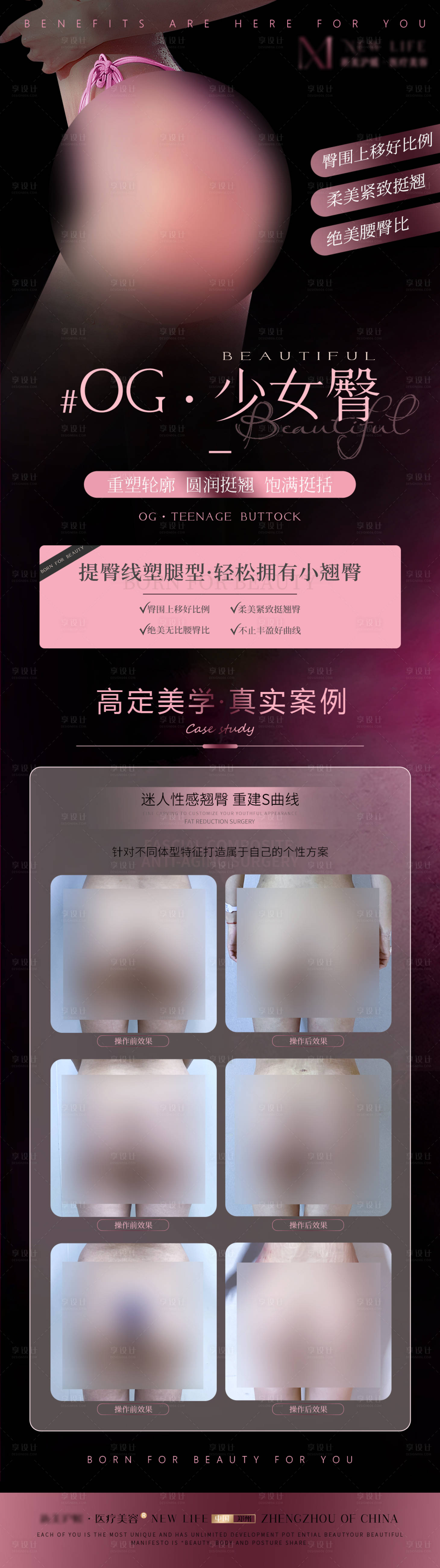 源文件下载【享设计】搜索编号：76610027755378055【医美丰臀品相案例海报】