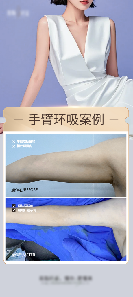 源文件下载【芊芊手臂海报】编号：45500027747354785