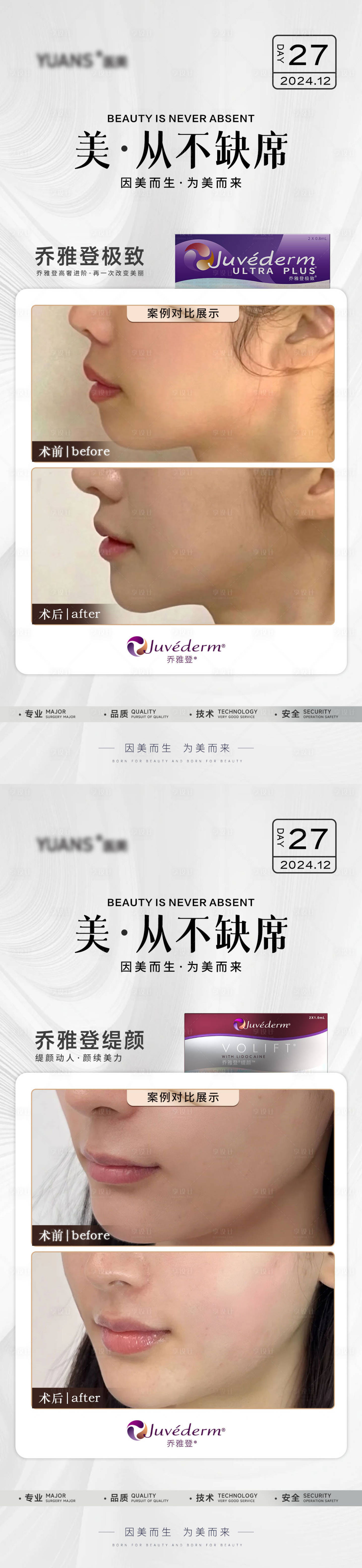 源文件下載【享設計】搜索編號：24930028089381431【醫美喬雅登案例對比】