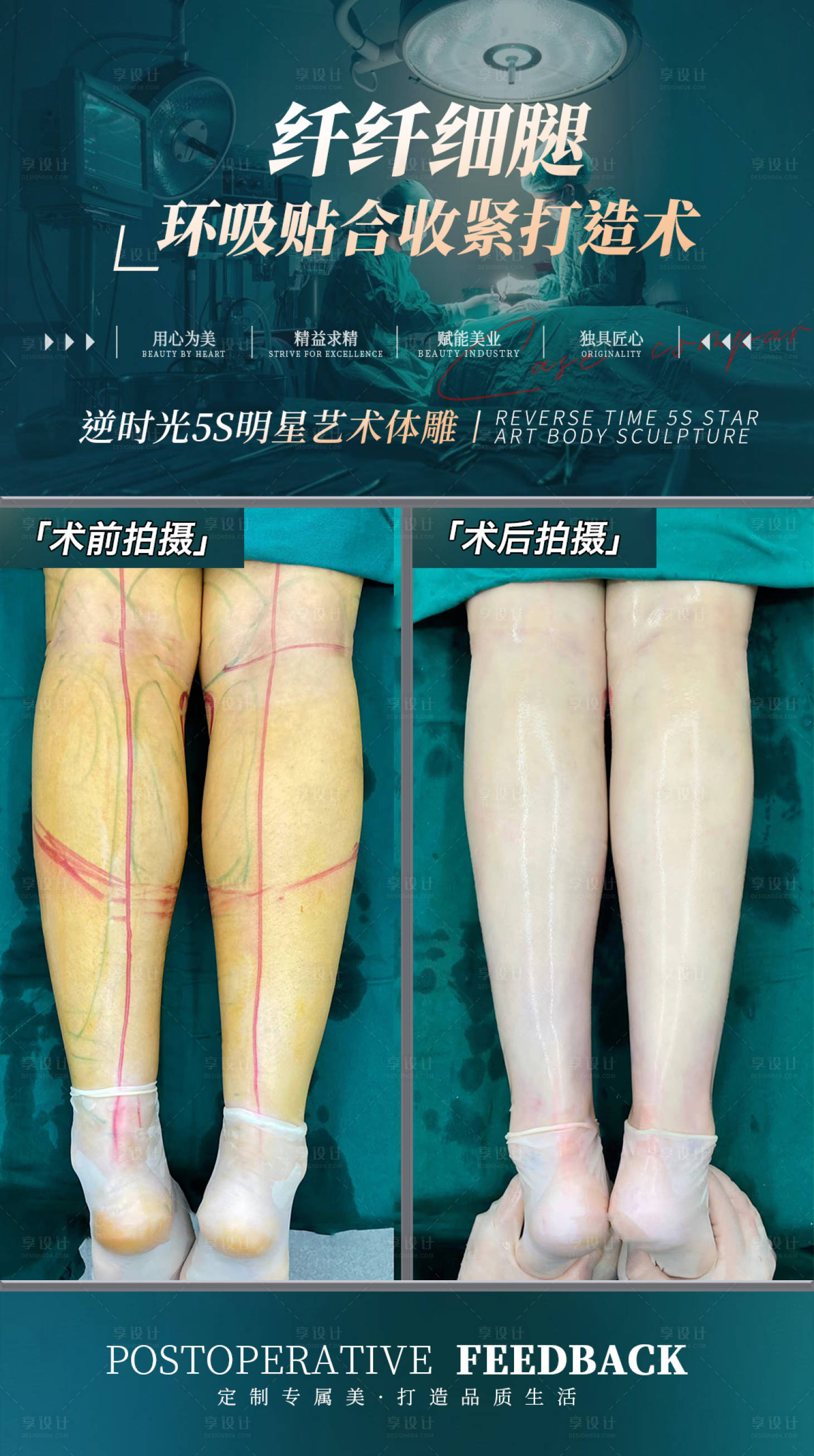 源文件下载【享设计】搜索编号：97560027668777433【美业小腿吸脂案例对比海报】