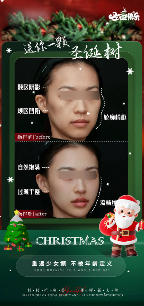 源文件下載【醫美圣誕節平安夜案例對比宣傳海報】編號：38050028002748061