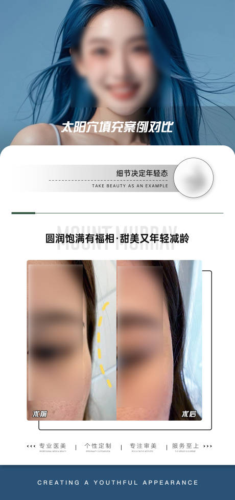 源文件下載【享設計】搜索編號：84230027688567394【醫美太陽穴填充案例對比海報】