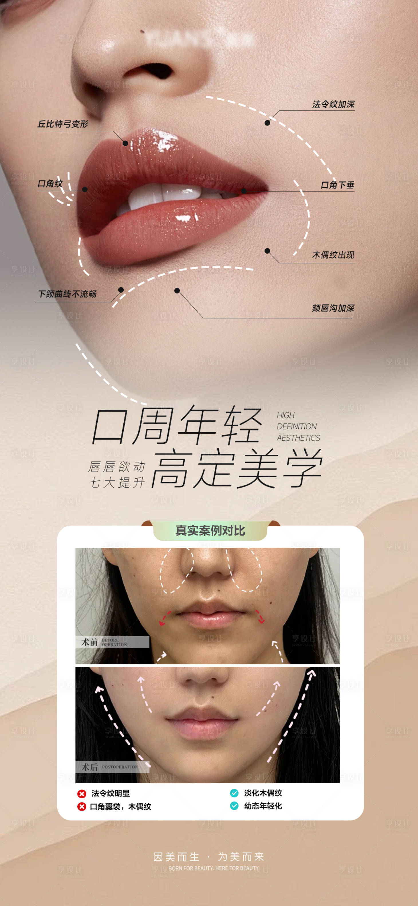 源文件下载【享设计】搜索编号：32890028142756156【医美口周案例对比图】