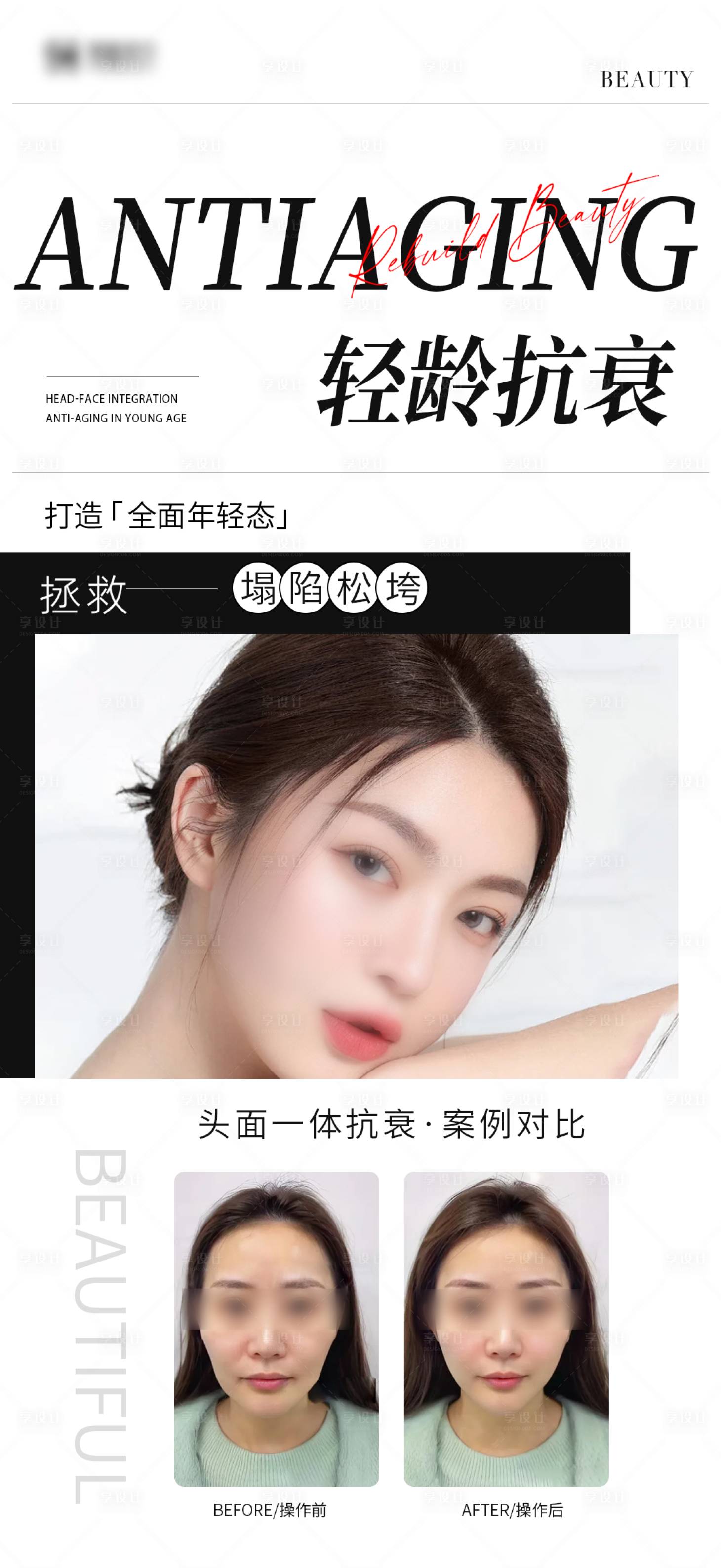 源文件下載【享設計】搜索編號：72080028056451020【抗衰案例海報】