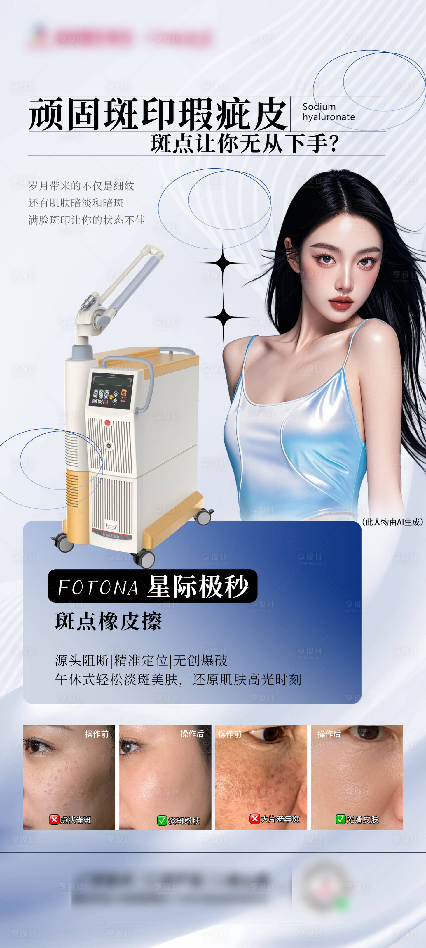 源文件下載【享設(shè)計(jì)】搜索編號：10760027849907750【醫(yī)美極秒祛斑海報(bào)】