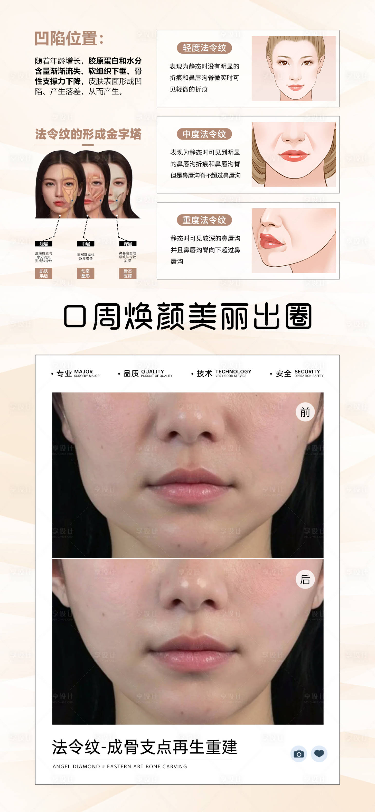 源文件下载【享设计】搜索编号：96800027678614300【法令纹案例对比海报】