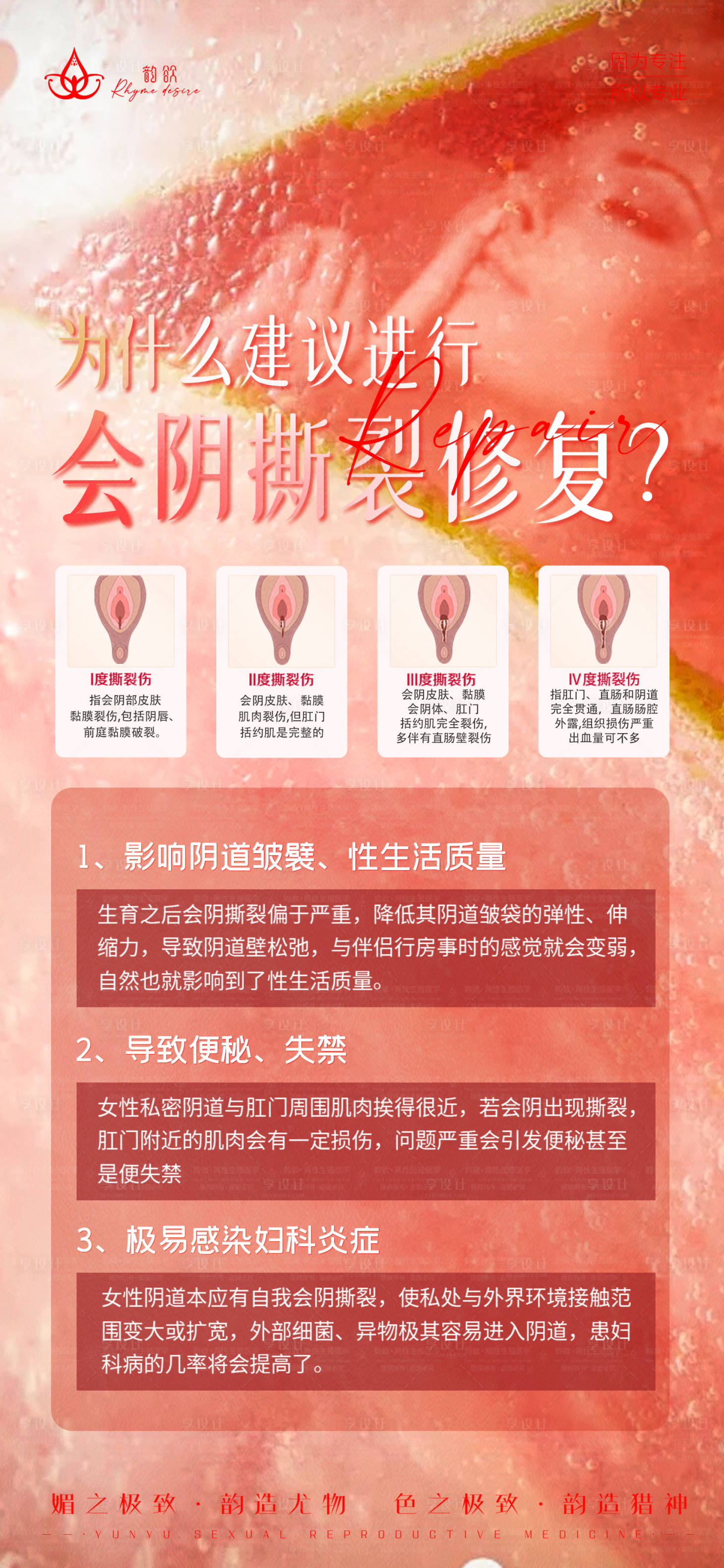 源文件下載【享設(shè)計】搜索編號：95180027698243826【女性會陰撕裂修復(fù)】