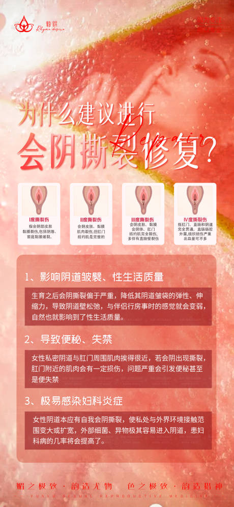 源文件下载【女性会阴撕裂修复】编号：95180027698243826