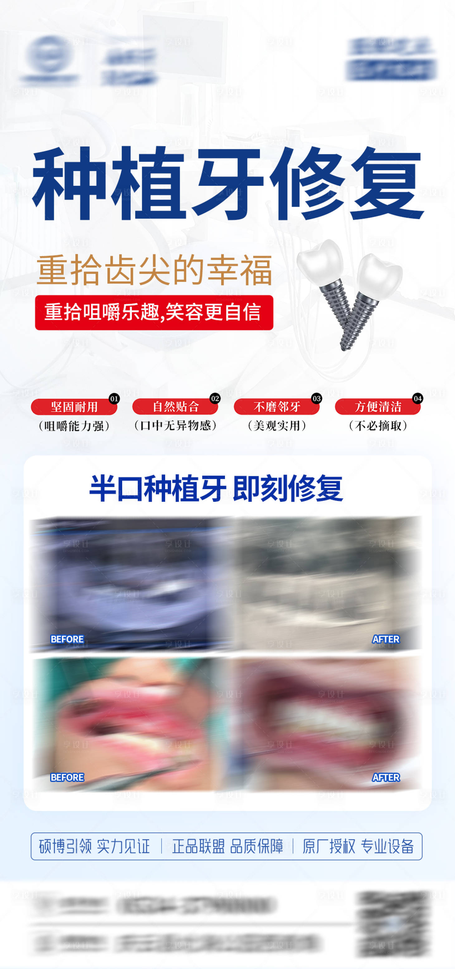 源文件下载【口腔种牙海报】编号：51450028112514609