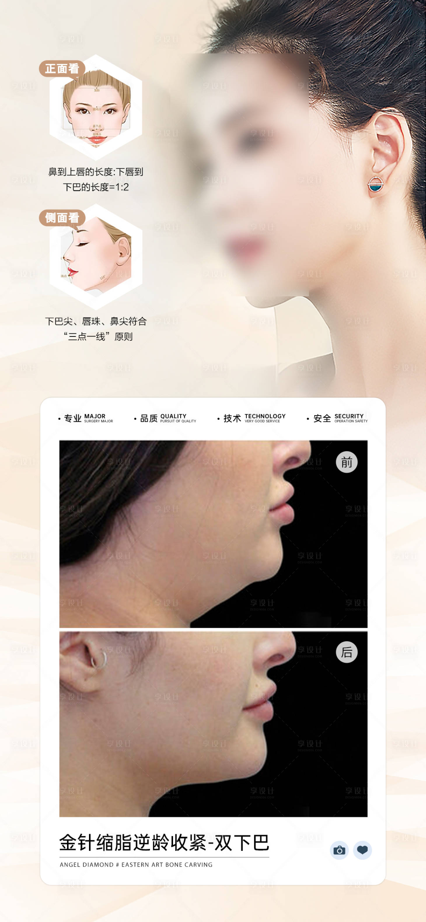 源文件下載【享設計】搜索編號：78840027666651790【醫美雙下巴案例對比海報】