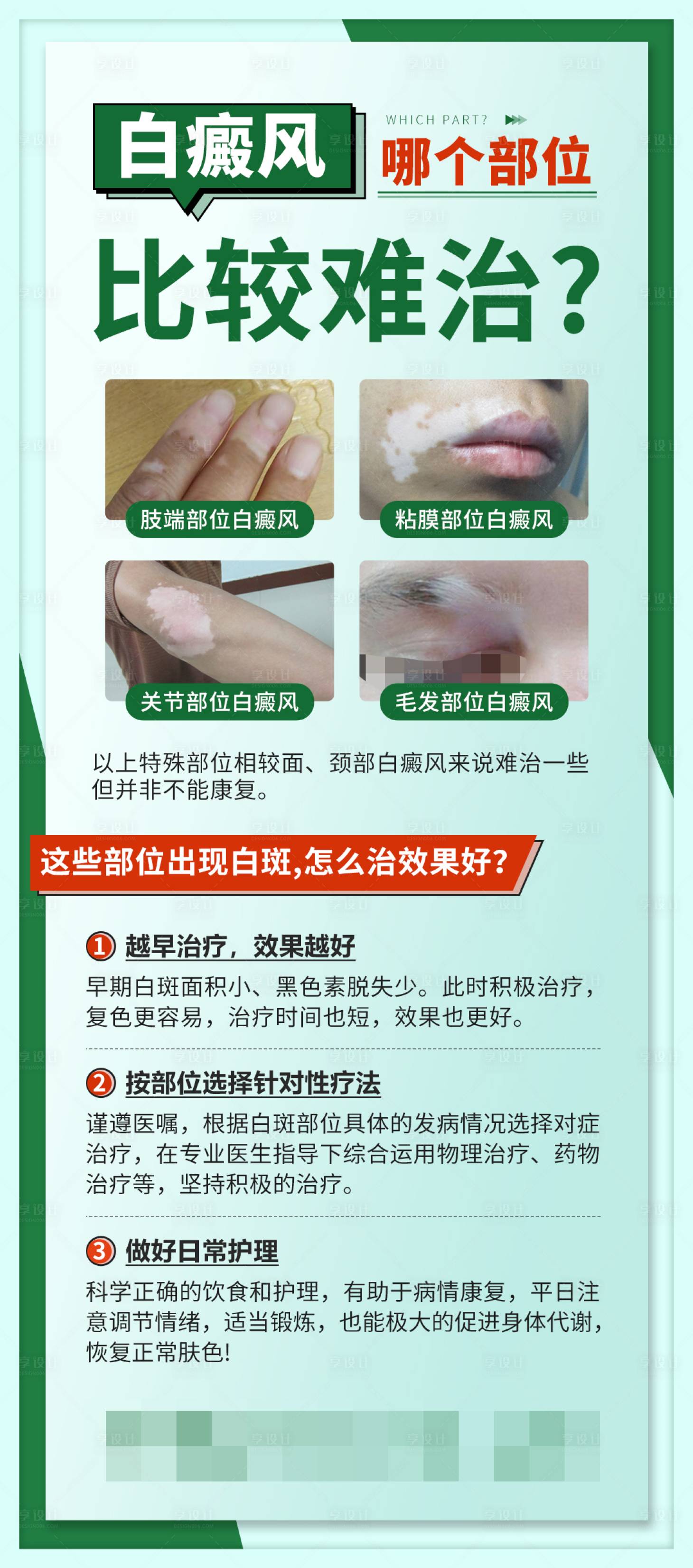 源文件下載【享設計】搜索編號：77430027731371468【綠色科普醫(yī)療常識指南白癜風海報】