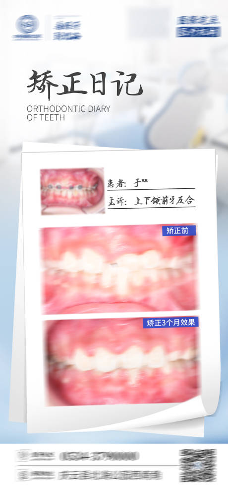 源文件下载【享设计】搜索编号：84690028112751732【口腔矫正海报】