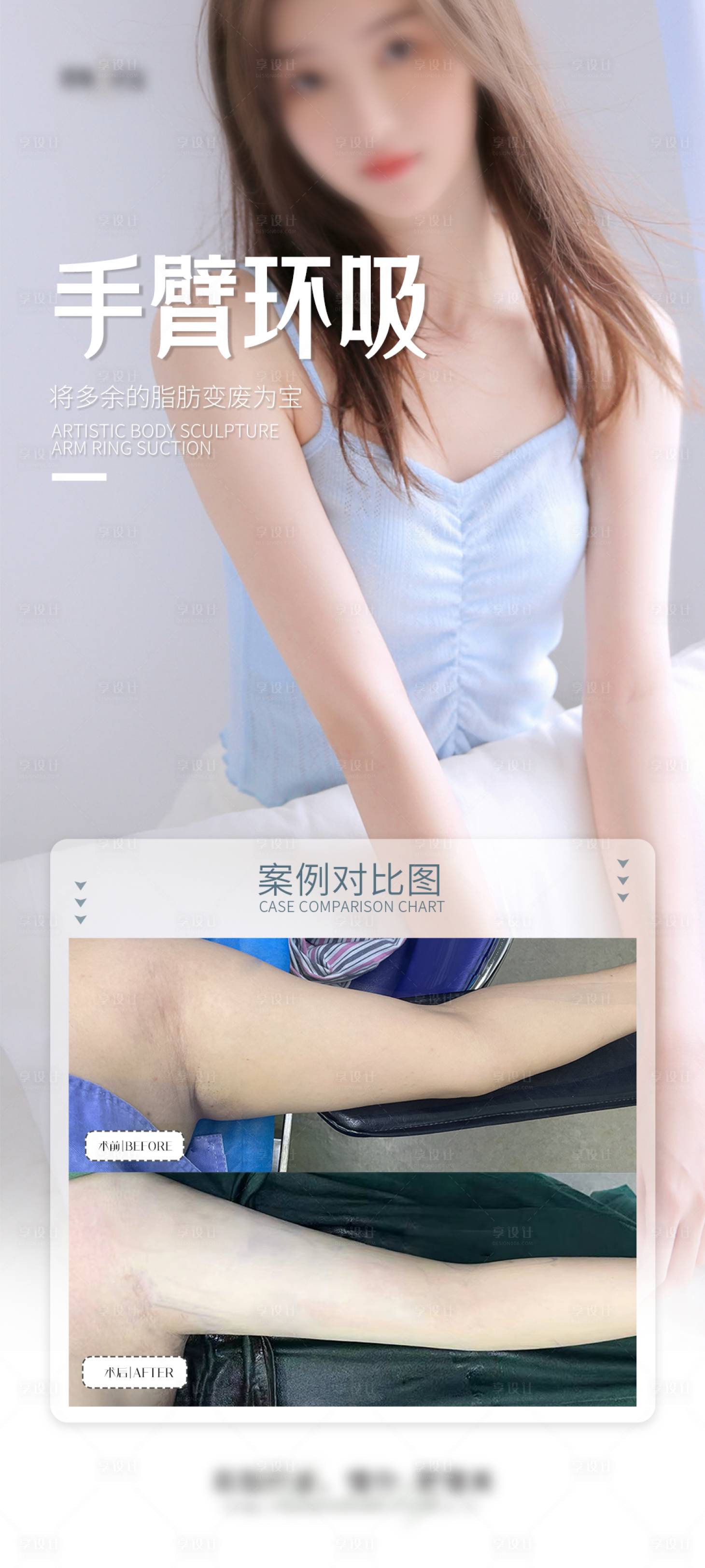 源文件下載【享設計】搜索編號：17050027859417234【手臂環吸案例海報】