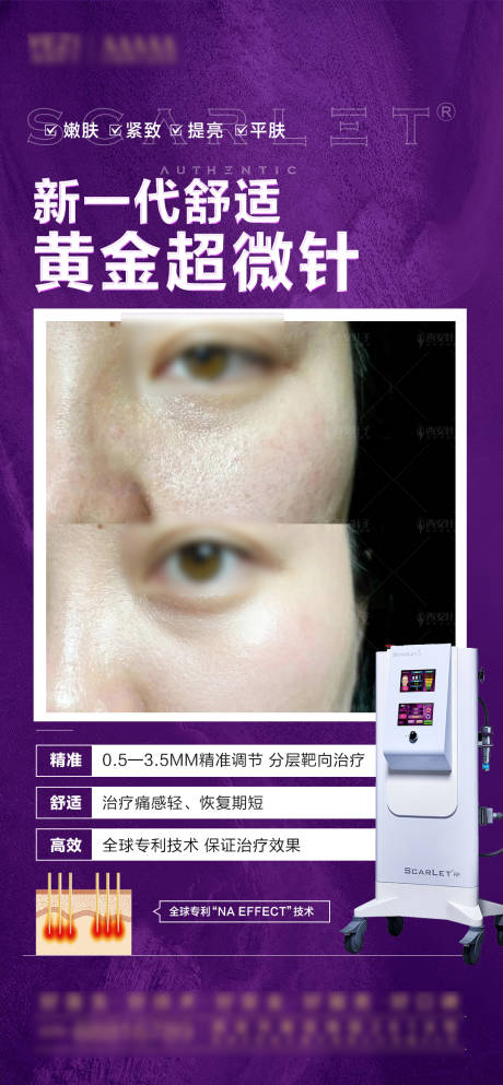 源文件下载【黄金微针案例海报】编号：81050028158728644
