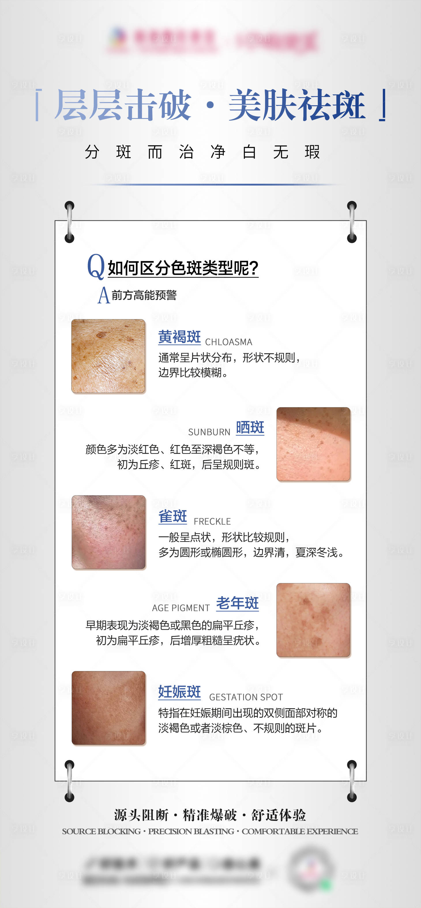源文件下載【享設(shè)計】搜索編號：74290027852705330【色斑分類科普】