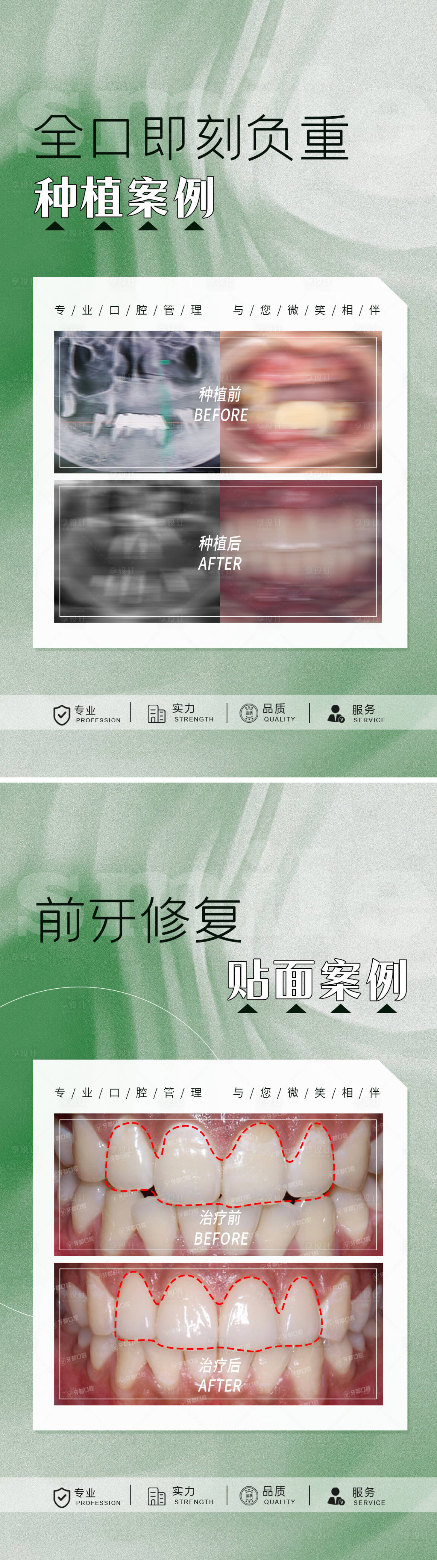 源文件下載【綠色質(zhì)感口腔案例對比圖】編號：17870028123388317