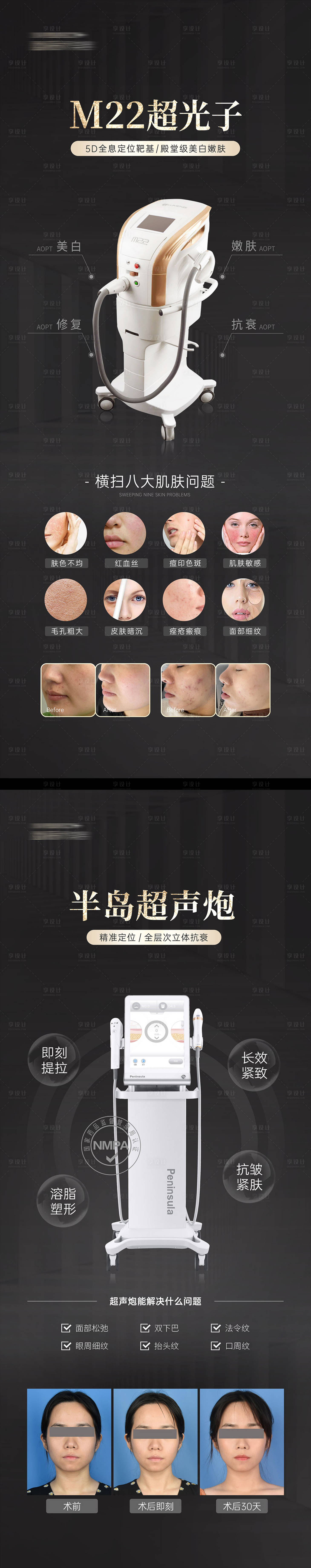 源文件下载【M22光子嫩肤超声炮易拉宝展架】编号：95880027831268700